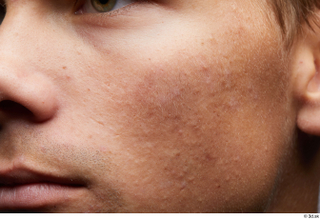 HD Face Skin Nathaniel cheek face lips mouth skin pores…